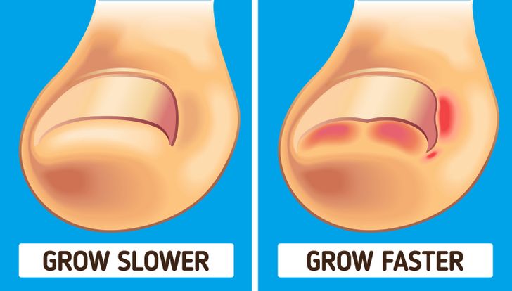 Why Fingernails Grow Faster Than Toenails