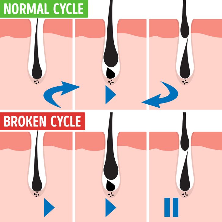 According to a Recent Study Guys Who Work a Lot Are More Likely to End Up Bald