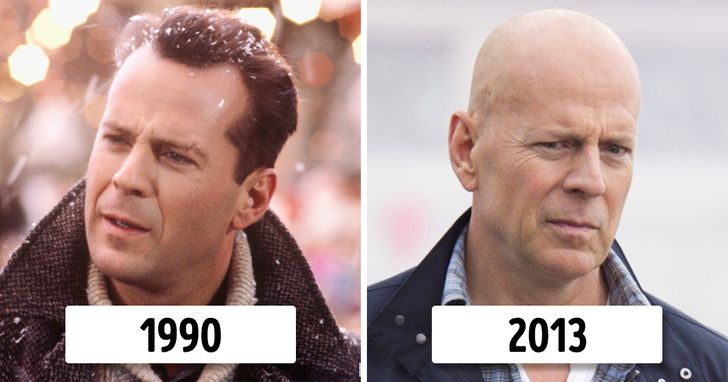 According to a Recent Study Guys Who Work a Lot Are More Likely to End Up Bald